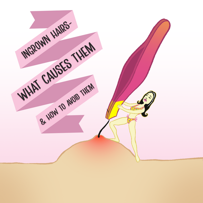 Ingrown Hair- What Really Causes Them And How To Avoid Them